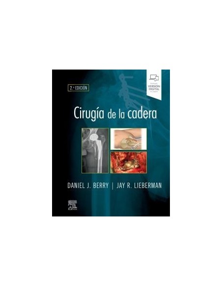 Cirugía de la cadera 2ª edición