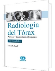 Radiología del Tórax. Patrones y Diagnósticos Diferenciales