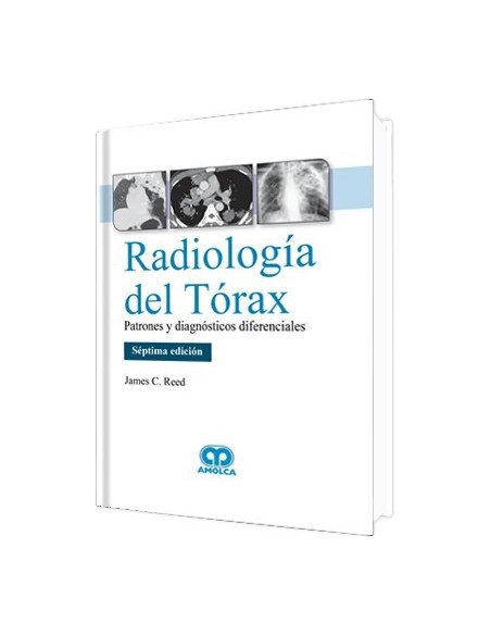 Radiología del Tórax. Patrones y Diagnósticos Diferenciales