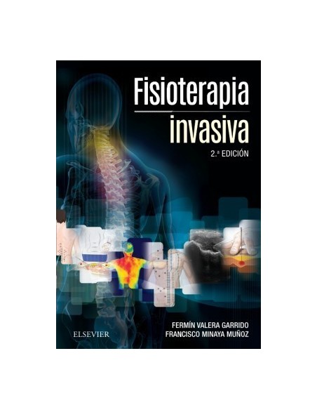 Fisioterapia invasiva + acceso online