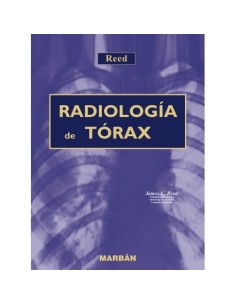 Reed. Radiología de Torax