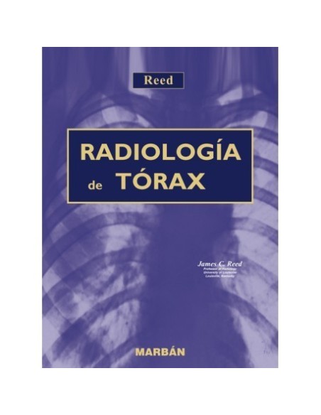 Reed. Radiología de Torax