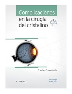 Complicaciones en la cirugía del cristalino + acceso online: Monografías SECOIR