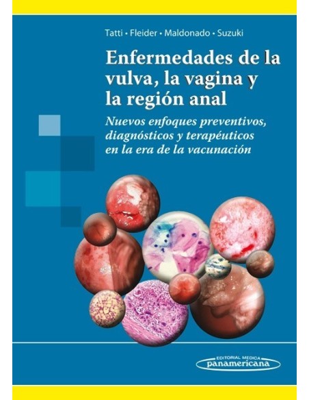 Enfermedades de la vulva