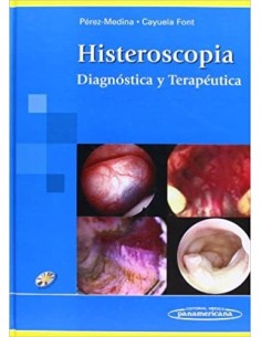 Histeroscopia Diagnóstica y Terapéutica
