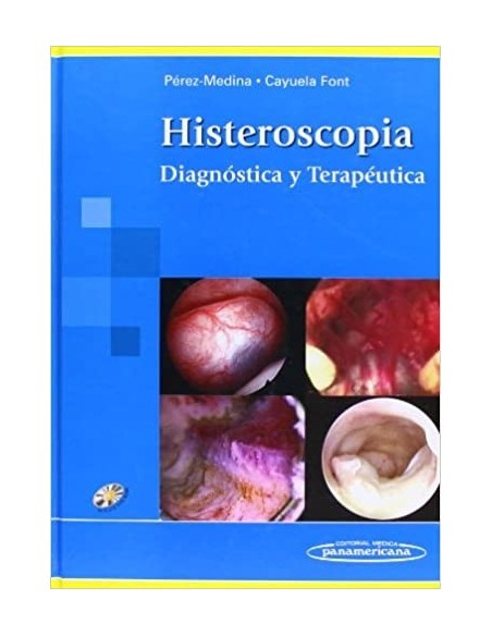 Histeroscopia Diagnóstica y Terapéutica
