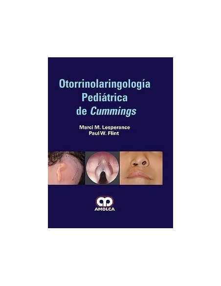 Otorrinolaringología Pediátrica de Cummings
