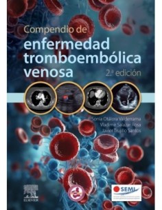 Compendio de enfermedad tromboembólica venosa