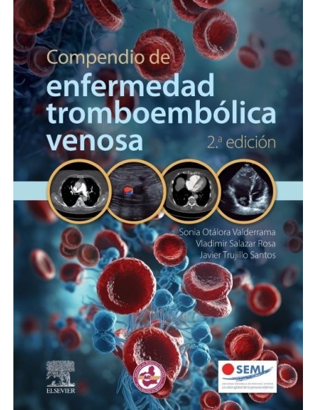 Compendio de enfermedad tromboembólica venosa