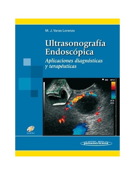 Ultrasonografía Endoscópica Aplicaciones diagnósticas y terapéuticas