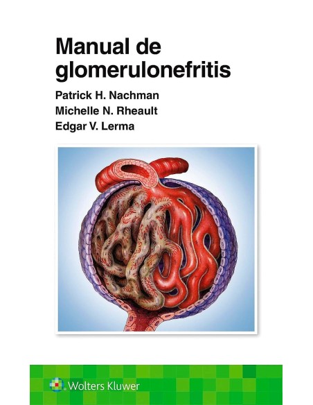 Manual de Glomerulonefritis