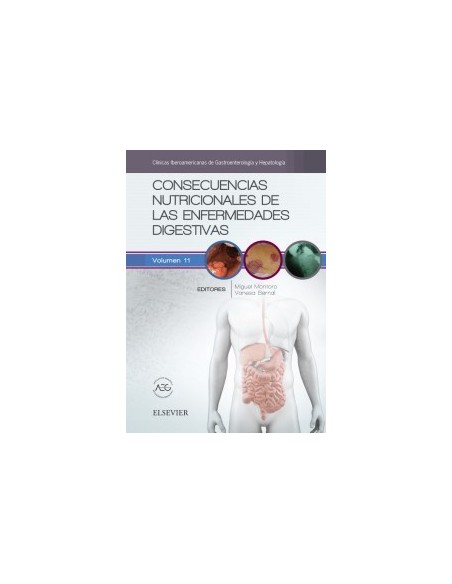 Consecuencias nutricionales de las enfermedades digestivas: Clínicas Iberoamericanas de Gastroenterología y Hepatología vol.11