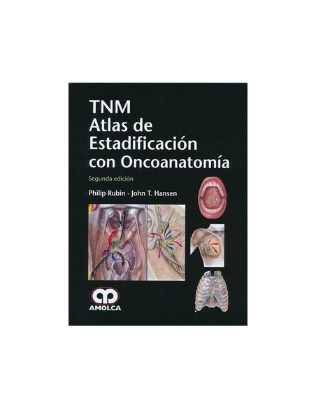 TNM Atlas de estadificación con oncoanatomía