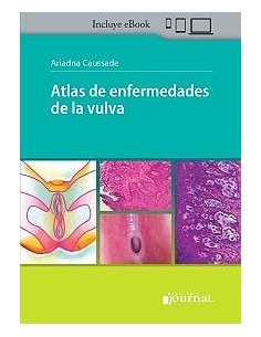 Atlas de Enfermedades de la Vulva