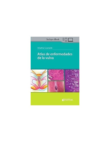 Atlas de Enfermedades de la Vulva