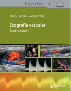 Ecografía Vascular