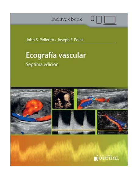 Ecografía Vascular